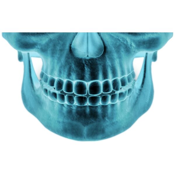 XRAY mouth Thumbnail